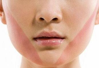 臉不對稱怎么辦