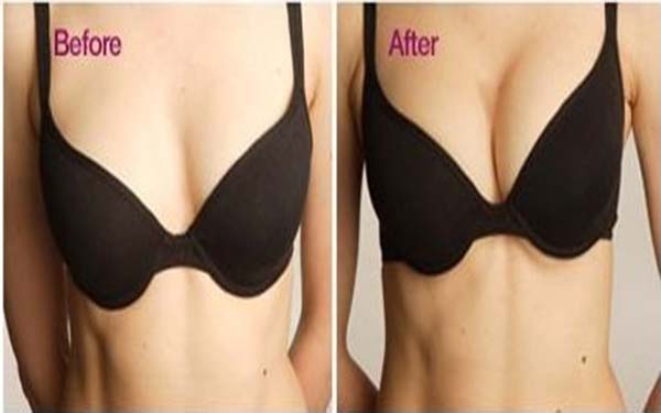 妙桃假體<a href=http://m.f3bb6.cn/listinfo-618-0.html target=_blank class=infotextkey>隆胸</a>手術需要多少錢