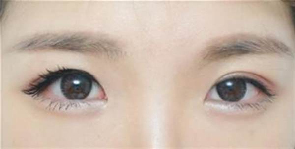 脂肪打<a href=http://m.f3bb6.cn/listinfo-722-0.html target=_blank class=infotextkey>臥蠶</a>多少錢