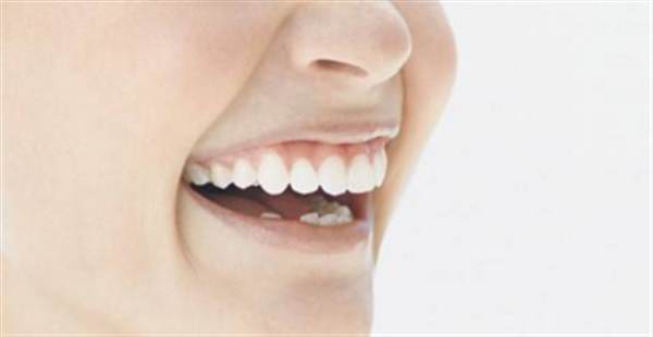 一般洗牙有哪幾種方式可行