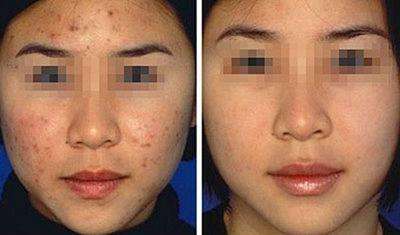 請(qǐng)問<a href=http://m.f3bb6.cn/listinfo-730-0.html target=_blank class=infotextkey>黑臉娃娃</a>可以祛皺<a href=http://m.f3bb6.cn/listinfo-795-0.html target=_blank class=infotextkey>祛斑</a>嗎