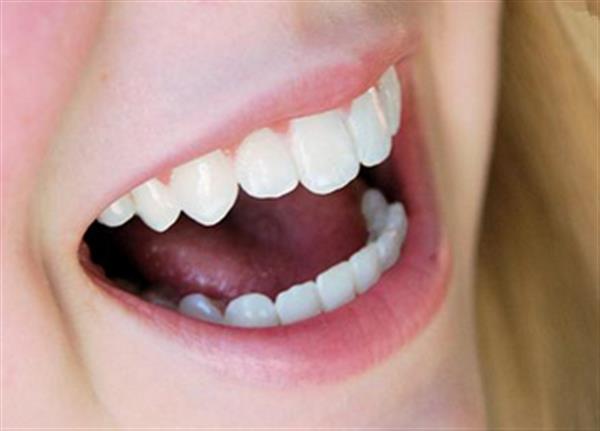 無鈹<a href=http://m.f3bb6.cn/listinfo-829-0.html target=_blank class=infotextkey>烤瓷牙</a>術前注意事項