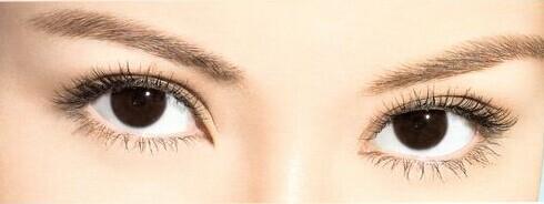 什么是無痕開內眼角術