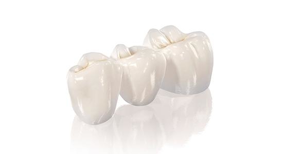 做一顆<a href=http://m.f3bb6.cn/listinfo-829-0.html target=_blank class=infotextkey>烤瓷牙</a>需要多少錢(qián)