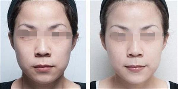 彩光<a href=http://m.f3bb6.cn/listinfo-770-0.html target=_blank class=infotextkey>嫩膚</a>術后需要注意哪些