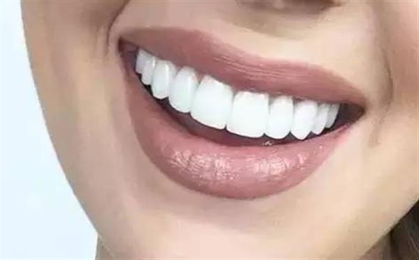 <a href=http://m.f3bb6.cn/listinfo-827-0.html target=_blank class=infotextkey>瓷貼面</a>能維持多久