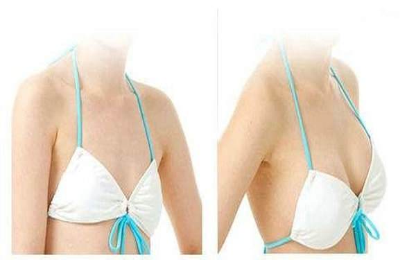 假體<a href=http://m.f3bb6.cn/listinfo-618-0.html target=_blank class=infotextkey>隆胸</a>好在哪里