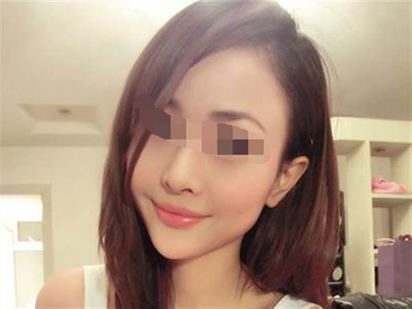 <a href=http://m.f3bb6.cn/listinfo-629-0.html target=_blank class=infotextkey>下頜角</a>切除手術(shù)的價格和優(yōu)點有哪些