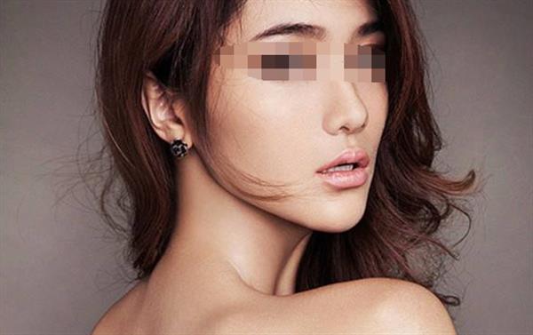 假體<a href=http://m.f3bb6.cn/listinfo-737-0.html target=_blank class=infotextkey>隆鼻</a>術后注意事項有哪些