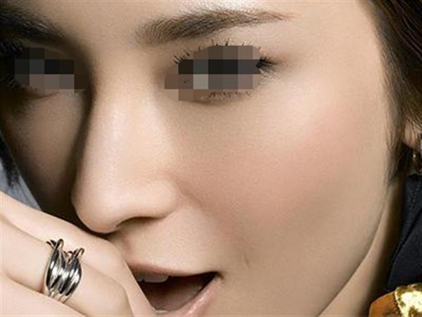 打透明質酸<a href=http://m.f3bb6.cn/listinfo-737-0.html target=_blank class=infotextkey>隆鼻</a>能維持多久