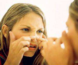 做黑頭大概多少錢