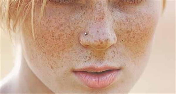 激光<a href=http://m.f3bb6.cn/listinfo-795-0.html target=_blank class=infotextkey>祛斑</a>后怎么護理好