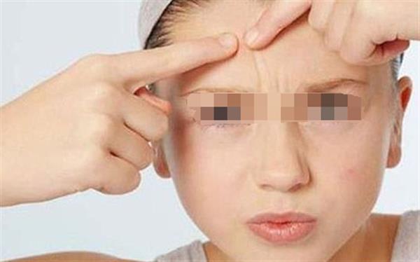 臉上有痘印怎么去除