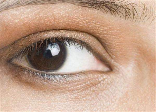 眼臺修復的正確方法