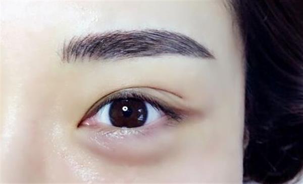 <a href=http://m.f3bb6.cn/listinfo-655-0.html target=_blank class=infotextkey>切眉</a>和提眉的區別