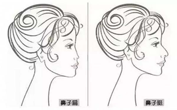 假體<a href=http://m.f3bb6.cn/listinfo-737-0.html target=_blank class=infotextkey>隆鼻</a>術的四個誤區(qū)有哪些？