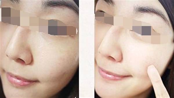 光子<a href=http://m.f3bb6.cn/listinfo-770-0.html target=_blank class=infotextkey>嫩膚</a>美容的原理