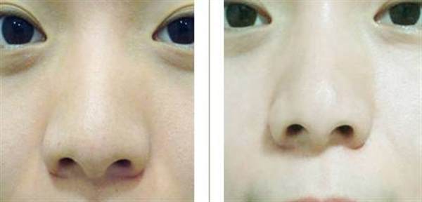 彩光<a href=http://m.f3bb6.cn/listinfo-770-0.html target=_blank class=infotextkey>嫩膚</a>的治療過程是怎么樣的