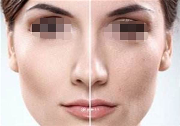 彩光<a href=http://m.f3bb6.cn/listinfo-770-0.html target=_blank class=infotextkey>嫩膚</a>后的注意事項有哪些