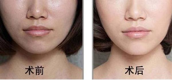 采光<a href=http://m.f3bb6.cn/listinfo-770-0.html target=_blank class=infotextkey>嫩膚</a>的原理是什么