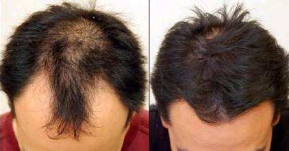 發跡線調整多少錢