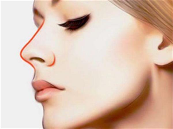 膨體<a href=http://m.f3bb6.cn/listinfo-737-0.html target=_blank class=infotextkey>隆鼻</a>手術(shù)手術(shù)后注意事項(xiàng)有哪些