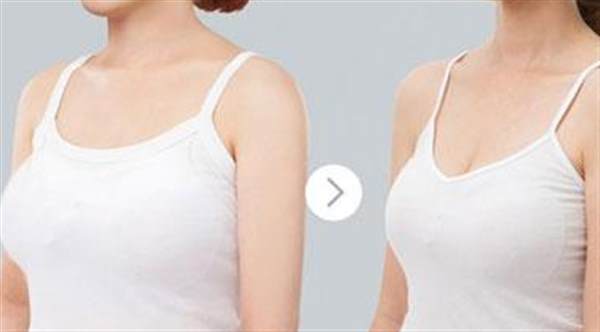 是否適合作乳房縮小整形