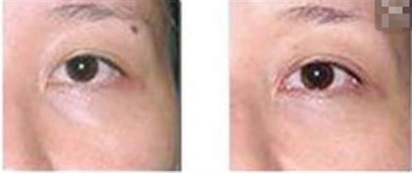 貴陽<a href=http://m.f3bb6.cn/listinfo-767-0.html target=_blank class=infotextkey>祛痣</a>多少錢