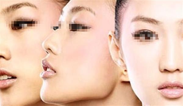 哪些人不適合進行光子<a href=http://m.f3bb6.cn/listinfo-770-0.html target=_blank class=infotextkey>嫩膚</a>