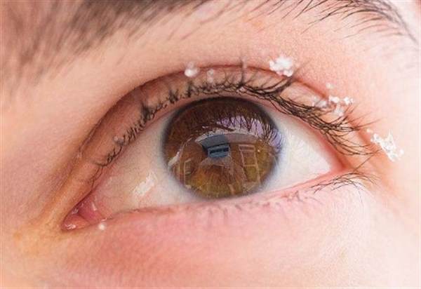 眼臺修復手術安全嗎