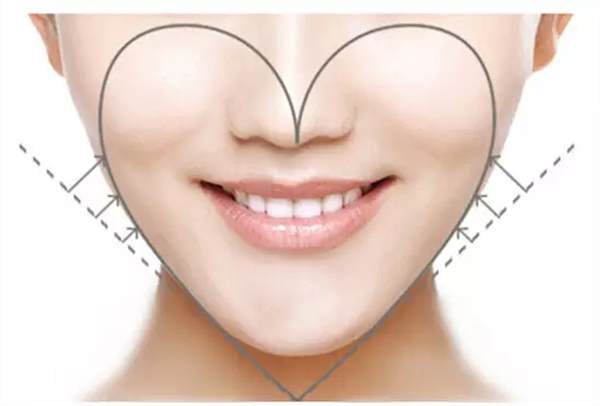 脂肪填充臉多久能消腫