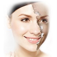 脂肪填充全臉恢復過程