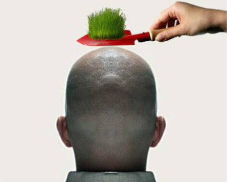 植發需要多少錢