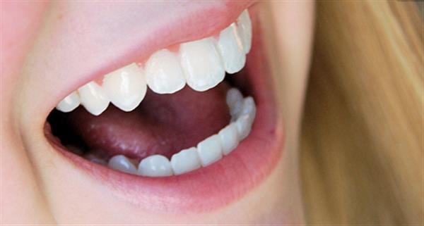 有哪些人適合做<a href=http://m.f3bb6.cn/listinfo-829-0.html target=_blank class=infotextkey>烤瓷牙</a>手術