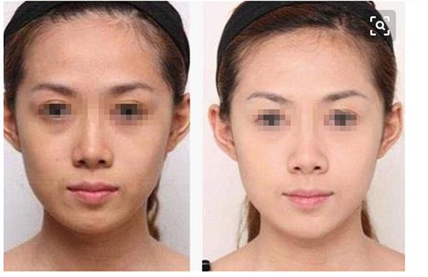 彩光<a href=http://m.f3bb6.cn/listinfo-763-0.html target=_blank class=infotextkey><a href=http://m.f3bb6.cn/listinfo-770-0.html target=_blank class=infotextkey>嫩膚</a>美白</a>后要如何護理