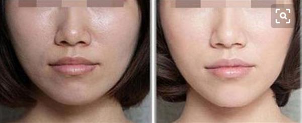 彩光<a href=http://m.f3bb6.cn/listinfo-770-0.html target=_blank class=infotextkey>嫩膚</a>的注意事項有哪些