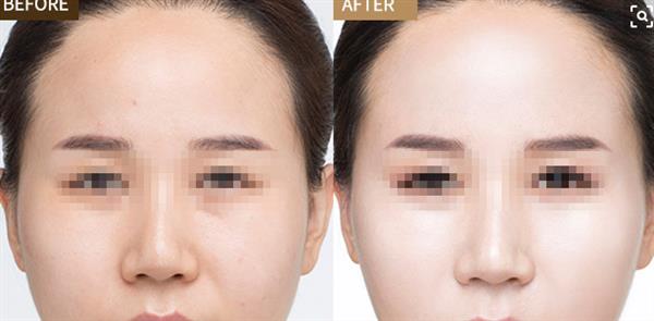 彩光<a href=http://m.f3bb6.cn/listinfo-770-0.html target=_blank class=infotextkey>嫩膚</a>的優點有哪些