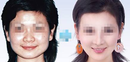 光子<a href=http://m.f3bb6.cn/listinfo-770-0.html target=_blank class=infotextkey>嫩膚</a>的危害、缺陷