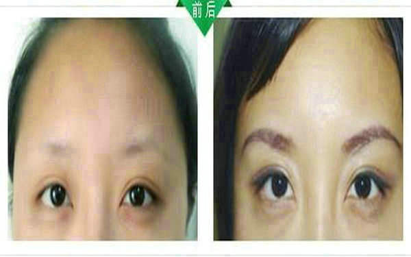 <a href=http://m.f3bb6.cn/listinfo-655-0.html target=_blank class=infotextkey>切眉</a>多久可以<a href=http://m.f3bb6.cn/listinfo-657-0.html target=_blank class=infotextkey>繡眉</a>?