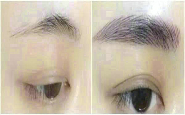 <a href=http://m.f3bb6.cn/listinfo-655-0.html target=_blank class=infotextkey>切眉</a>多久能紋眉?