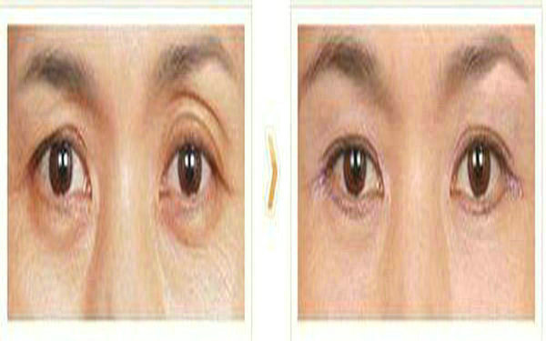 <a href=http://m.f3bb6.cn/listinfo-655-0.html target=_blank class=infotextkey>切眉</a>后多久能紋眉?