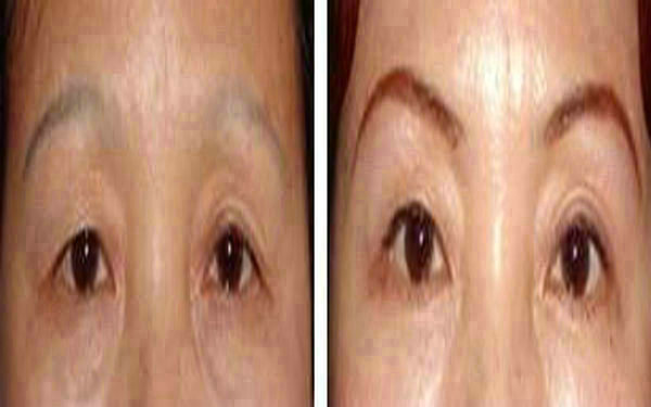 <a href=http://m.f3bb6.cn/listinfo-655-0.html target=_blank class=infotextkey>切眉</a>后多長時間紋眉?