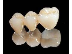 純鈦<a href=http://m.f3bb6.cn/listinfo-829-0.html target=_blank class=infotextkey>烤瓷牙</a>多少錢