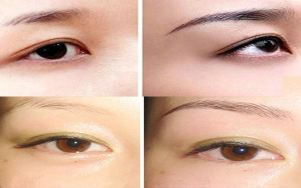 <a href=http://m.f3bb6.cn/listinfo-655-0.html target=_blank class=infotextkey>切眉</a>要多少錢?