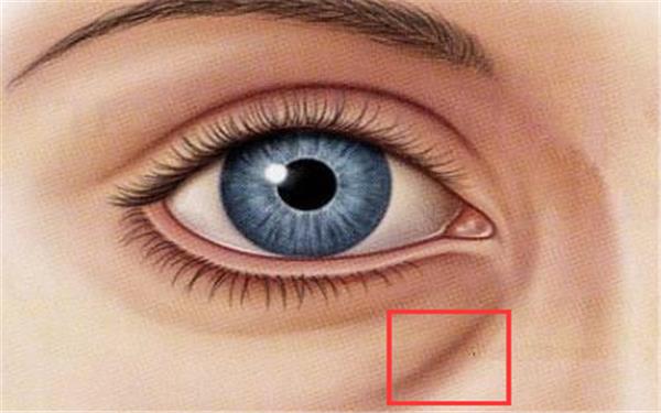 霧化淚溝注意事項
