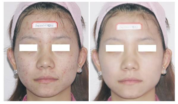 光子美白<a href=http://m.f3bb6.cn/listinfo-770-0.html target=_blank class=infotextkey>嫩膚</a>多少錢