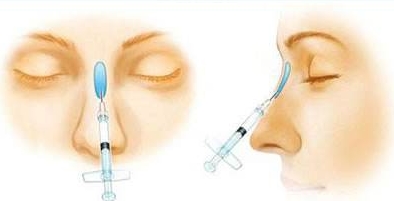 注射<a href=http://m.f3bb6.cn/listinfo-737-0.html target=_blank class=infotextkey>隆鼻</a>整形術的價格