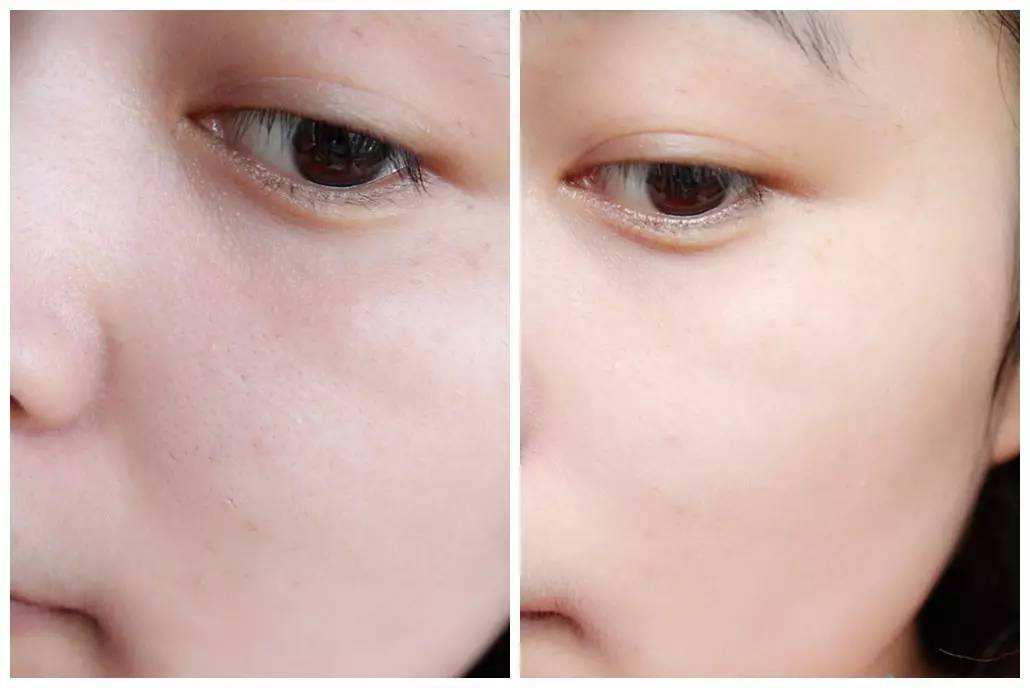 光子<a href=http://m.f3bb6.cn/listinfo-770-0.html target=_blank class=infotextkey>嫩膚</a>和果酸的區別