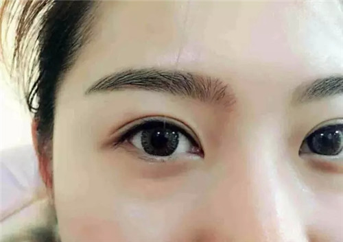 <a href=http://m.f3bb6.cn/listinfo-714-0.html target=_blank class=infotextkey>紋眼線</a>恢復過程圖