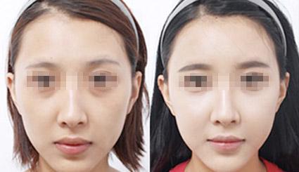 水光<a href=http://m.f3bb6.cn/listinfo-770-0.html target=_blank class=infotextkey>嫩膚</a>一般多少錢一只